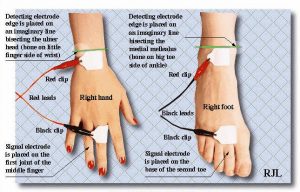 electrodes