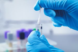 genetic testing